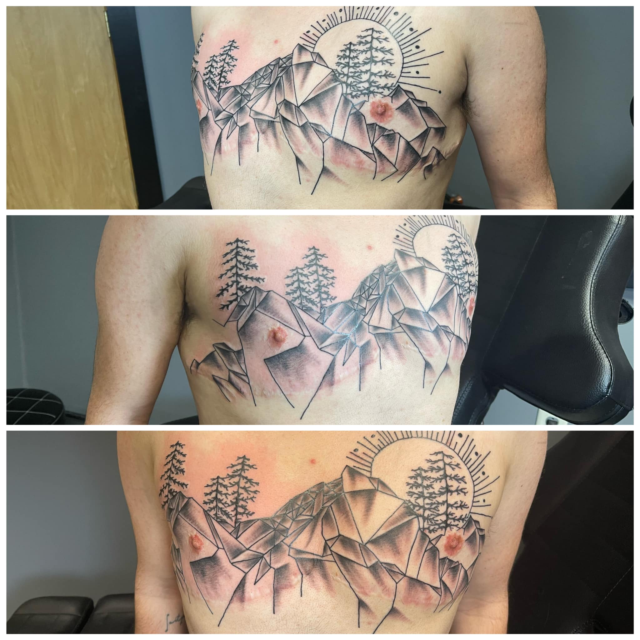 Tattooing over scars in St Albans, VT